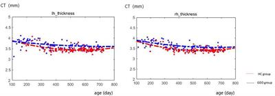 A structural MRI study of global developmental delay in infants (<2 years old)